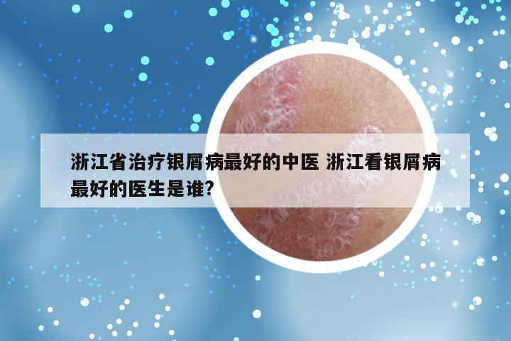 浙江省治疗银屑病最好的中医 浙江看银屑病最好的医生是谁?