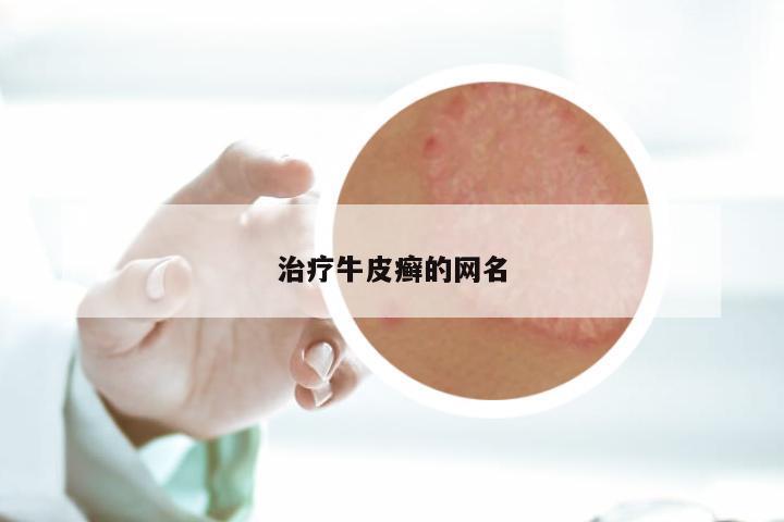 治疗牛皮癣的网名
