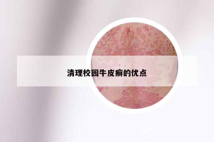 清理校园牛皮癣的优点