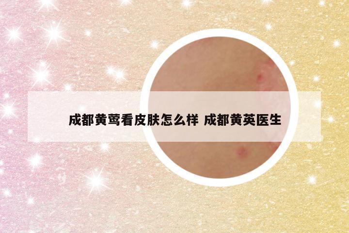 成都黄莺看皮肤怎么样 成都黄英医生