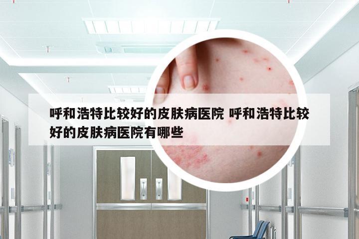 呼和浩特比较好的皮肤病医院 呼和浩特比较好的皮肤病医院有哪些