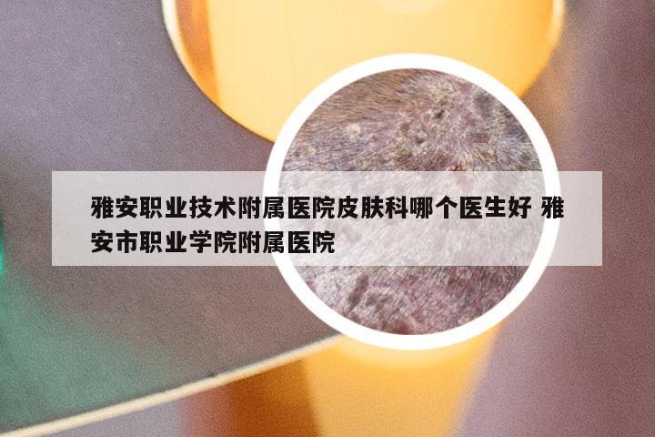 雅安职业技术附属医院皮肤科哪个医生好 雅安市职业学院附属医院
