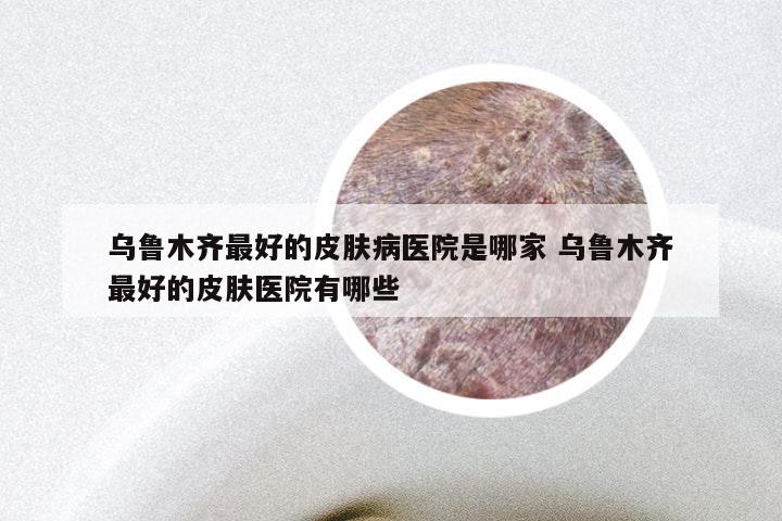 乌鲁木齐最好的皮肤病医院是哪家 乌鲁木齐最好的皮肤医院有哪些
