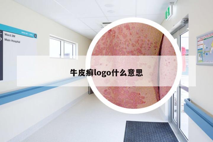 牛皮癣logo什么意思