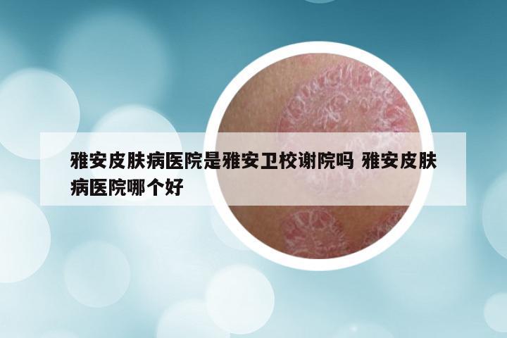 雅安皮肤病医院是雅安卫校谢院吗 雅安皮肤病医院哪个好