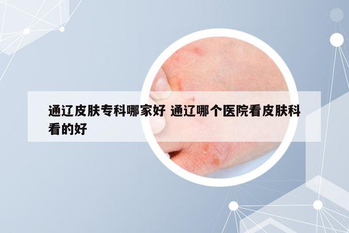 通辽皮肤专科哪家好 通辽哪个医院看皮肤科看的好