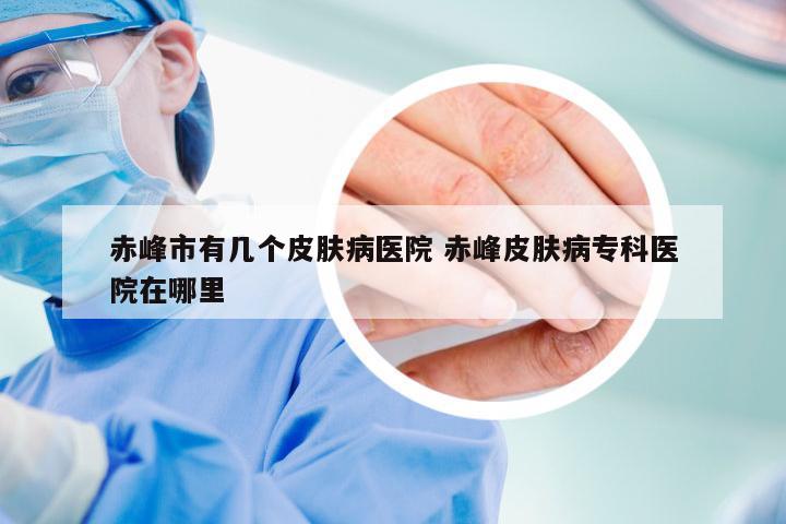 赤峰市有几个皮肤病医院 赤峰皮肤病专科医院在哪里