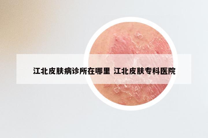 江北皮肤病诊所在哪里 江北皮肤专科医院