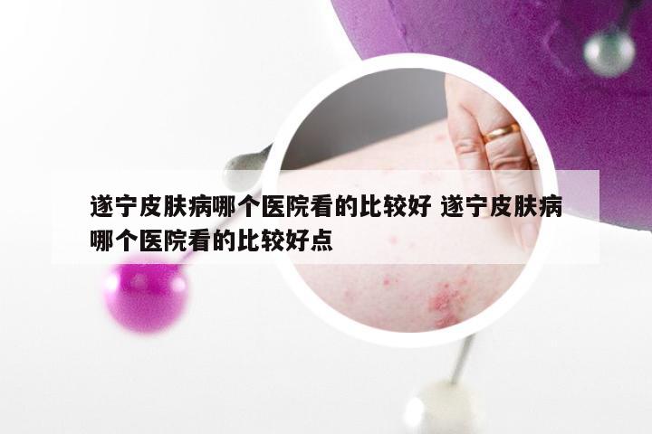 遂宁皮肤病哪个医院看的比较好 遂宁皮肤病哪个医院看的比较好点