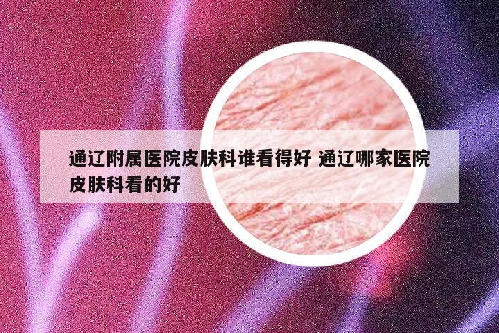 通辽附属医院皮肤科谁看得好 通辽哪家医院皮肤科看的好