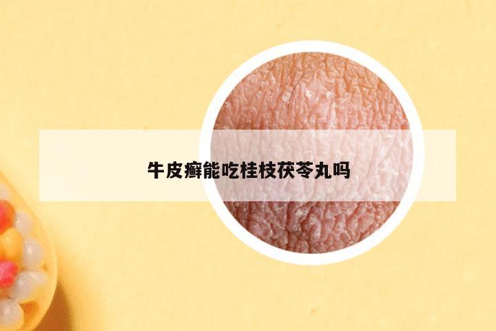 牛皮癣能吃桂枝茯苓丸吗