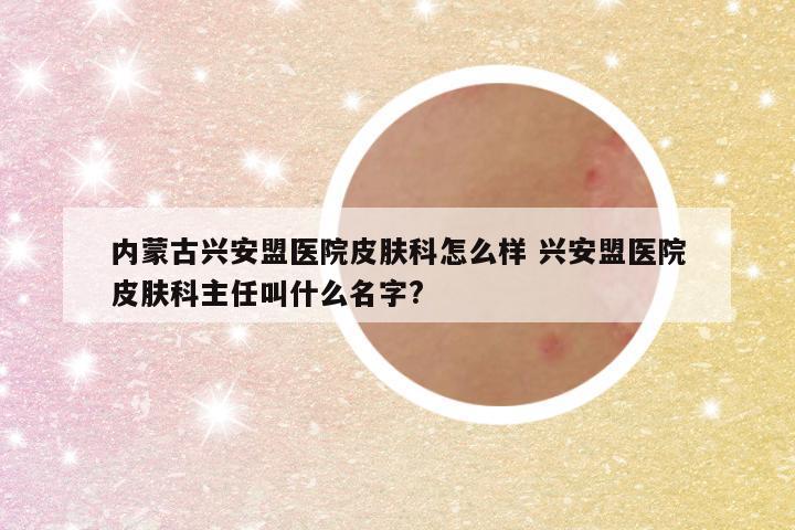 内蒙古兴安盟医院皮肤科怎么样 兴安盟医院皮肤科主任叫什么名字?