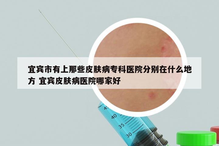 宜宾市有上那些皮肤病专科医院分别在什么地方 宜宾皮肤病医院哪家好