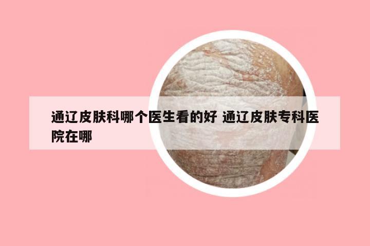 通辽皮肤科哪个医生看的好 通辽皮肤专科医院在哪