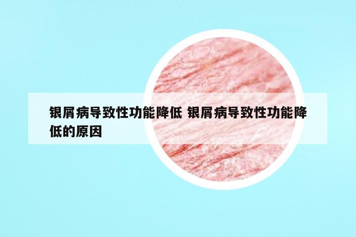 银屑病导致性功能降低 银屑病导致性功能降低的原因
