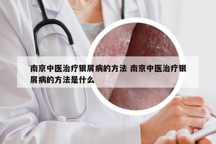 南京中医治疗银屑病的方法 南京中医治疗银屑病的方法是什么