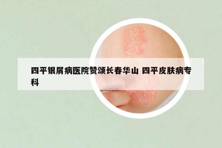 四平银屑病医院赞颂长春华山 四平皮肤病专科