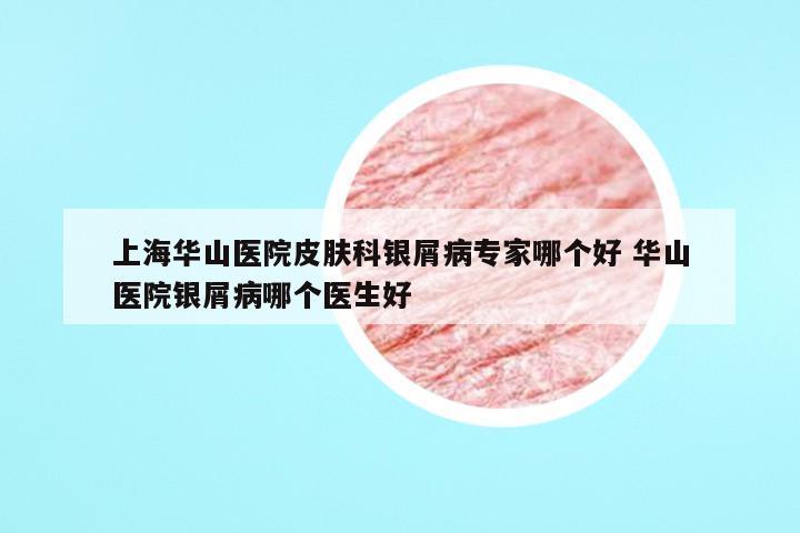 上海华山医院皮肤科银屑病专家哪个好 华山医院银屑病哪个医生好