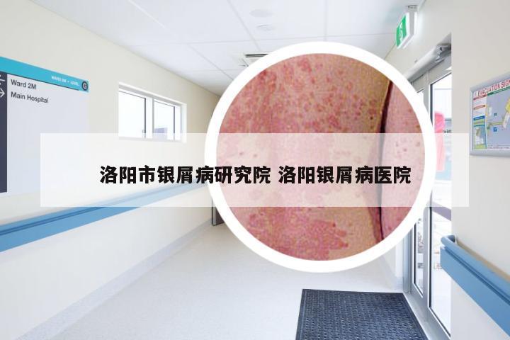 洛阳市银屑病研究院 洛阳银屑病医院
