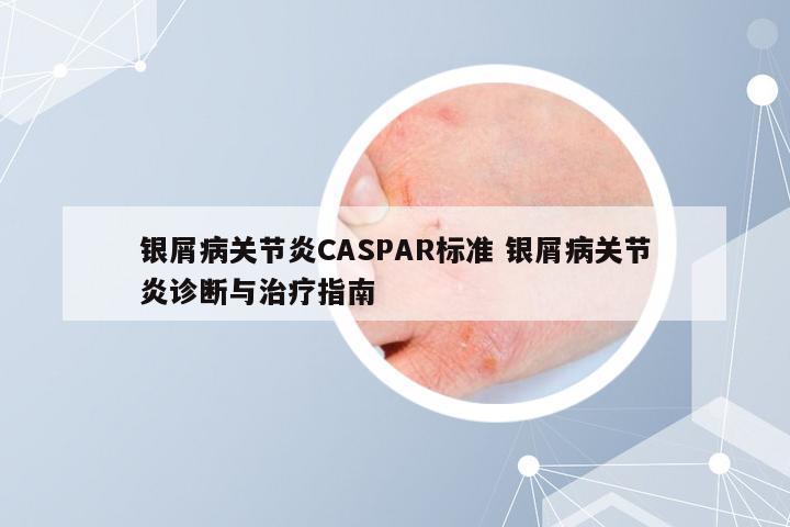 银屑病关节炎CASPAR标准 银屑病关节炎诊断与治疗指南