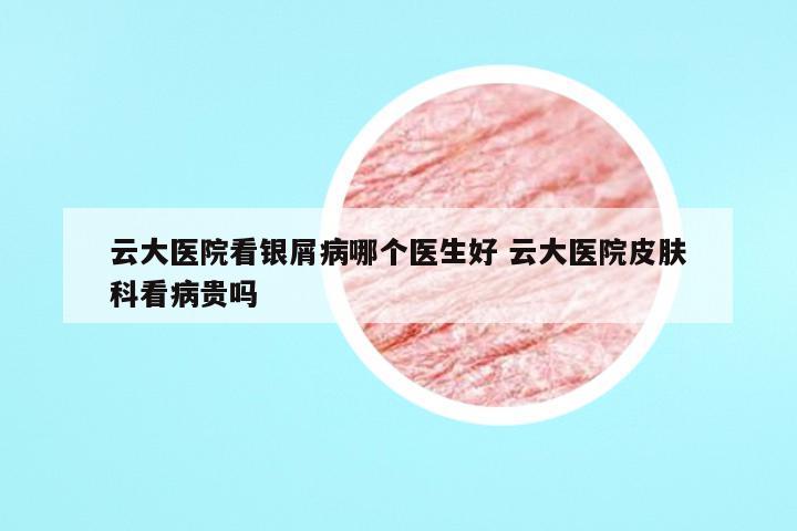云大医院看银屑病哪个医生好 云大医院皮肤科看病贵吗