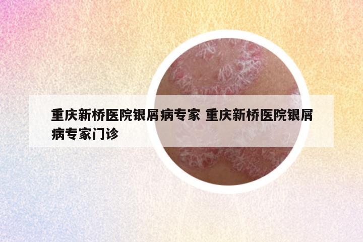 重庆新桥医院银屑病专家 重庆新桥医院银屑病专家门诊