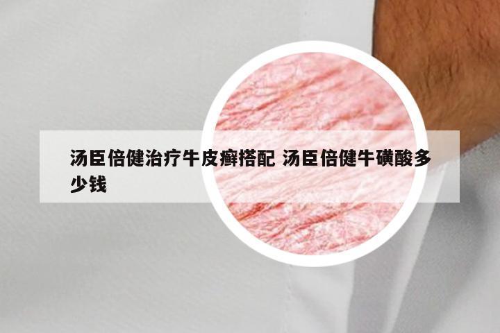 汤臣倍健治疗牛皮癣搭配 汤臣倍健牛磺酸多少钱