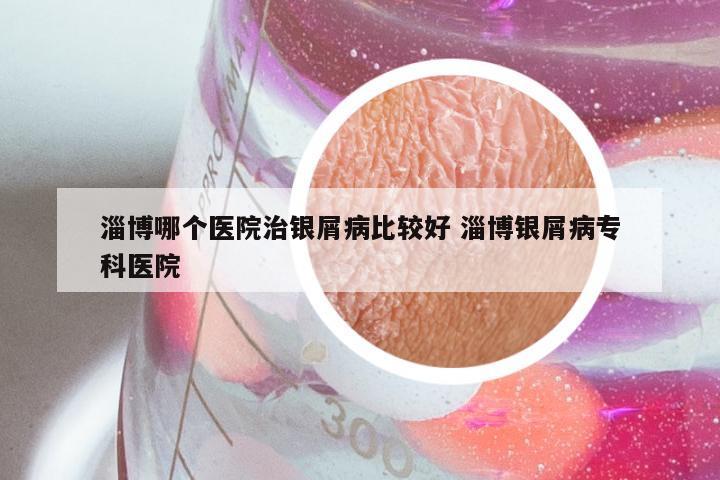 淄博哪个医院治银屑病比较好 淄博银屑病专科医院