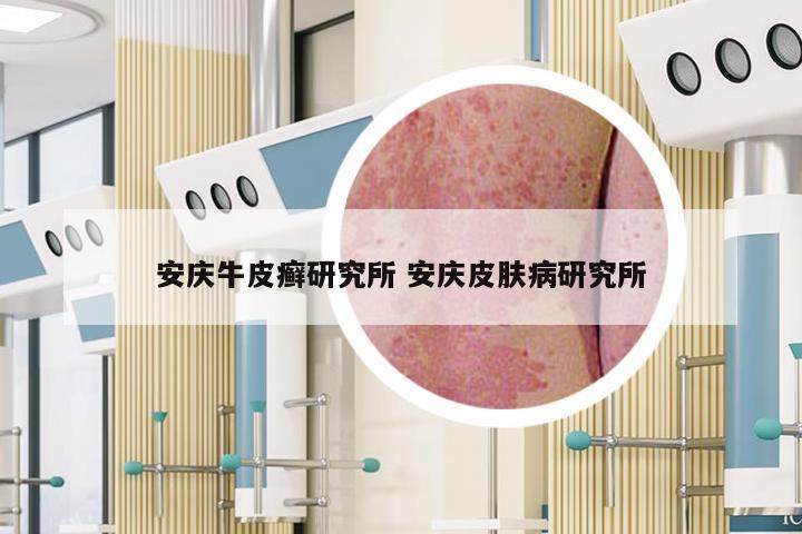安庆牛皮癣研究所 安庆皮肤病研究所