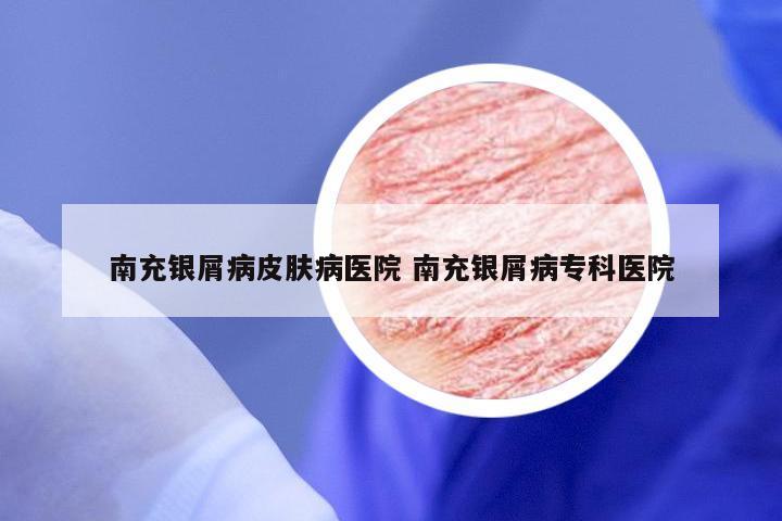 南充银屑病皮肤病医院 南充银屑病专科医院