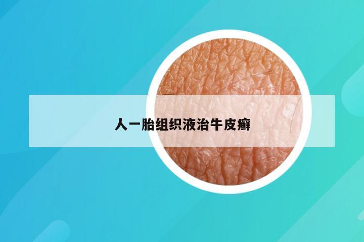 人一胎组织液治牛皮癣