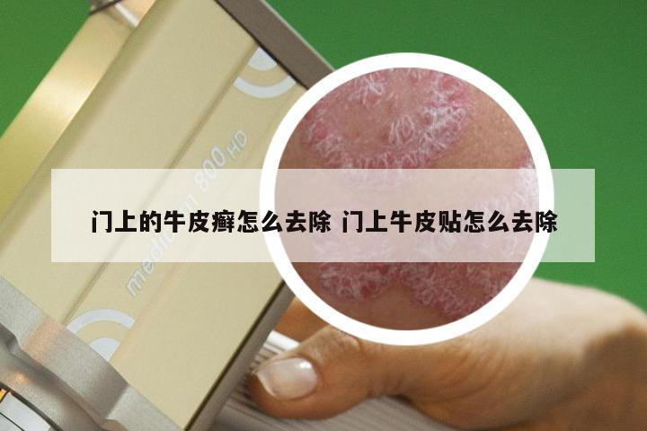 门上的牛皮癣怎么去除 门上牛皮贴怎么去除