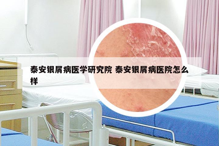 泰安银屑病医学研究院 泰安银屑病医院怎么样