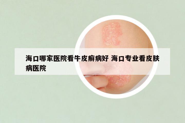 海口哪家医院看牛皮癣病好 海口专业看皮肤病医院