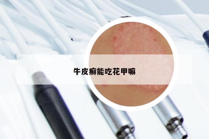牛皮癣能吃花甲嘛