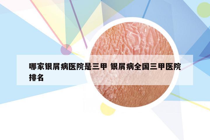 哪家银屑病医院是三甲 银屑病全国三甲医院排名