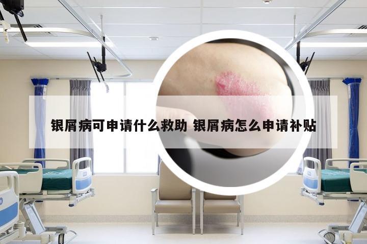 银屑病可申请什么救助 银屑病怎么申请补贴