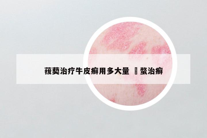菝葜治疗牛皮癣用多大量 螌蝥治癣