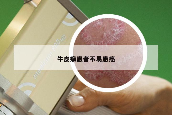 牛皮癣患者不易患癌