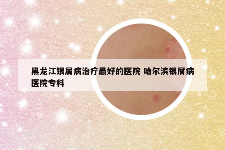 黑龙江银屑病治疗最好的医院 哈尔滨银屑病医院专科