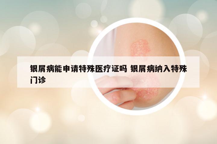 银屑病能申请特殊医疗证吗 银屑病纳入特殊门诊