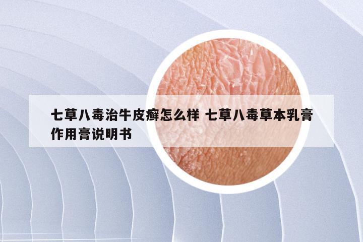 七草八毒治牛皮癣怎么样 七草八毒草本乳膏作用膏说明书