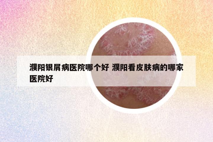 濮阳银屑病医院哪个好 濮阳看皮肤病的哪家医院好