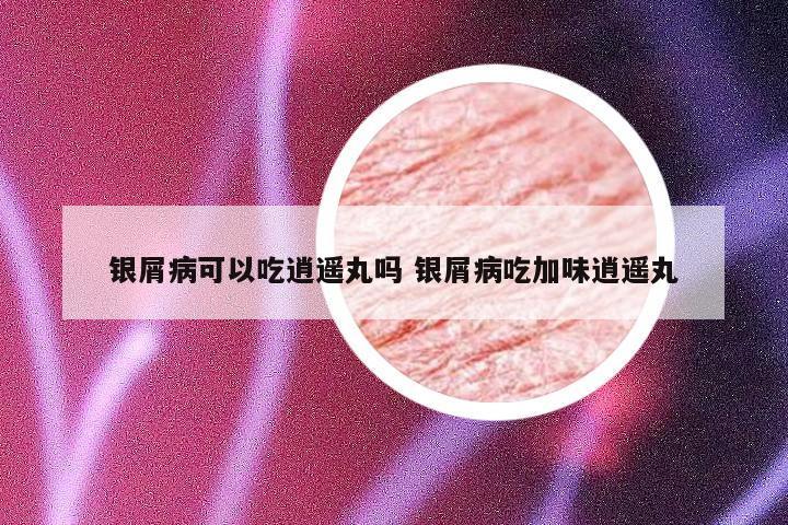 银屑病可以吃逍遥丸吗 银屑病吃加味逍遥丸