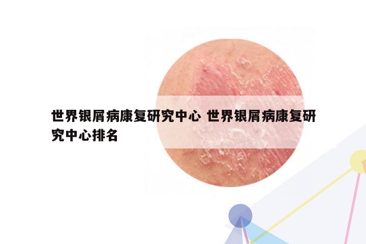 世界银屑病康复研究中心 世界银屑病康复研究中心排名