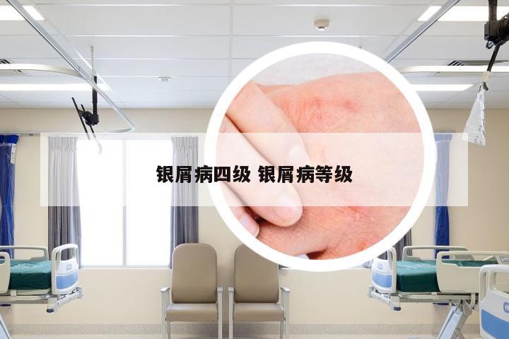 银屑病四级 银屑病等级