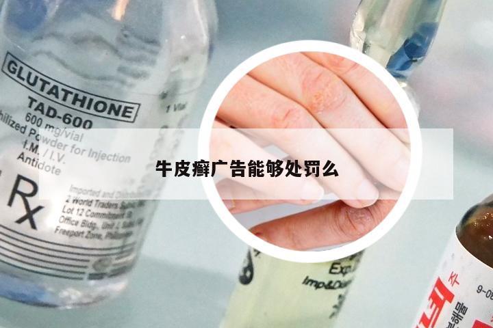 牛皮癣广告能够处罚么