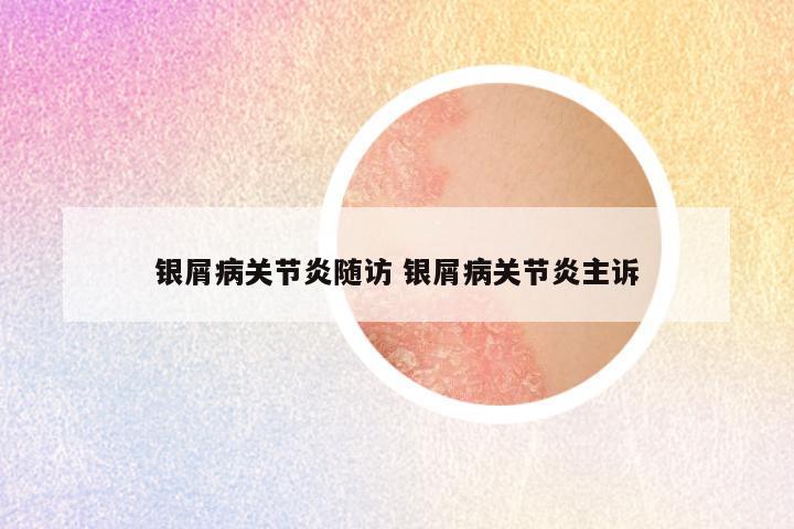 银屑病关节炎随访 银屑病关节炎主诉