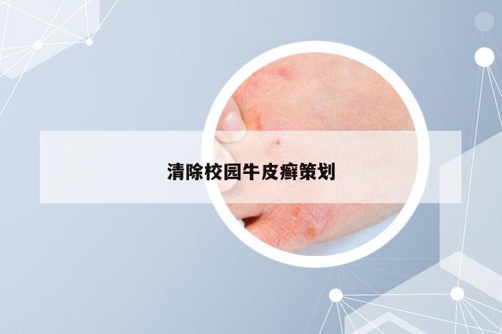 清除校园牛皮癣策划
