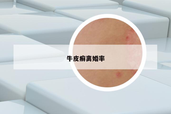 牛皮癣离婚率